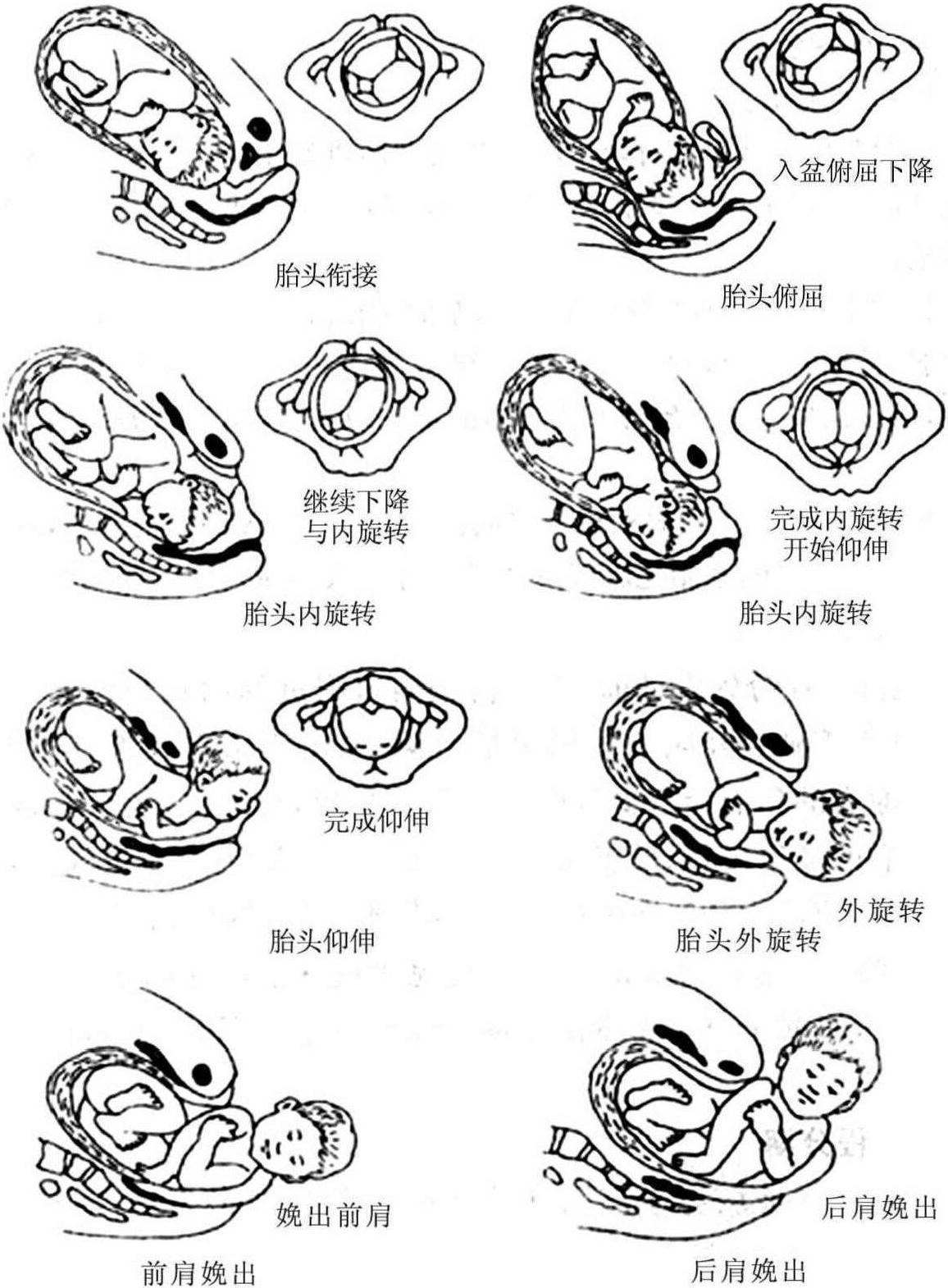 第三節(jié) 枕先露正常分娩機(jī)制